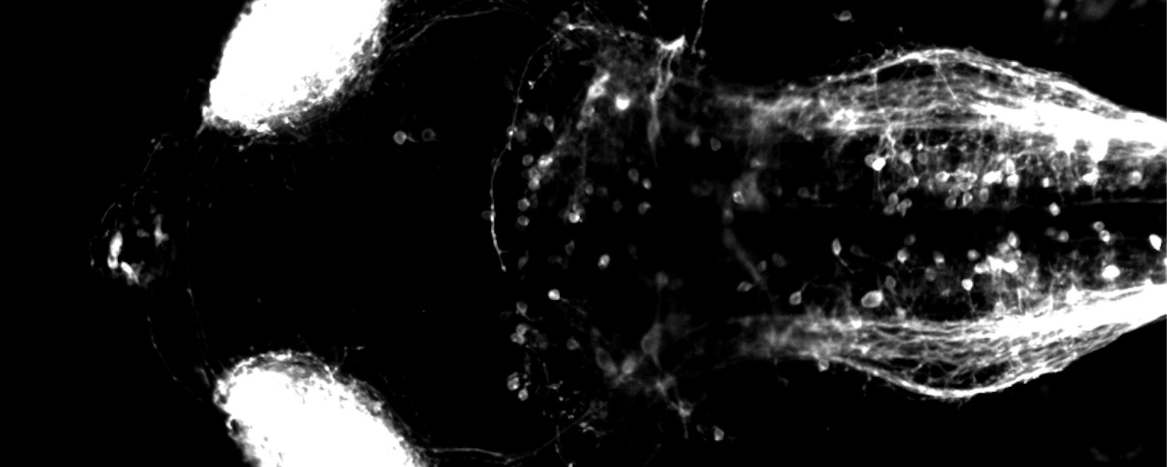 drd1 neurons in the larval zebrafish brain